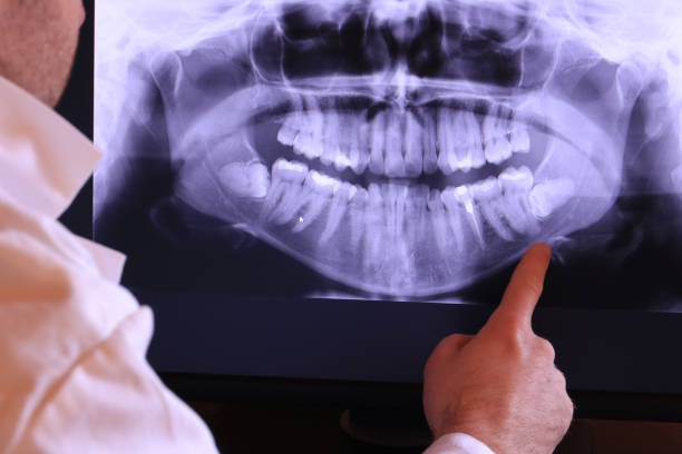 Best Emergency Tooth Extraction in Ruckersville, VA