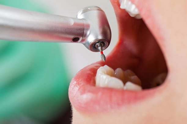 Best Same-Day Emergency Dentist in Ruckersville, VA